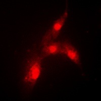 MDM2 (Phospho-S166) Rabbit Polyclonal Antibody