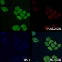 Merlin (Phospho-S518) Rabbit Polyclonal Antibody