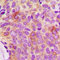 Osteoprotegerin Rabbit Polyclonal Antibody