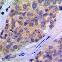 PLA2G4A (Phospho-S505) Rabbit Polyclonal Antibody