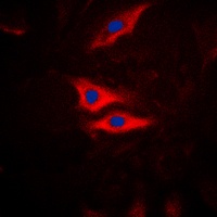 PLA2G4A (Phospho-S505) Rabbit Polyclonal Antibody