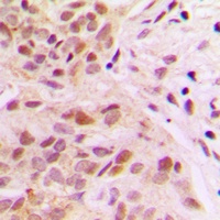 Rpb1 CTD (Phospho-S1619) Rabbit Polyclonal Antibody