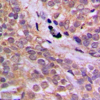 AMPK alpha 1 (Phospho-S496) Rabbit Polyclonal Antibody