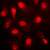AMPK alpha 1 (Phospho-S496) Rabbit Polyclonal Antibody