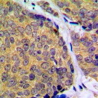 MKK2 (Phospho-T394) Rabbit Polyclonal Antibody