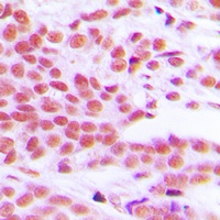 NF-kappaB p65 (Phospho-S529) Rabbit Polyclonal Antibody