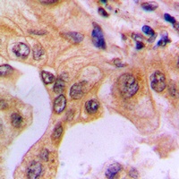 NF-kappaB p65 (Phospho-S529) Rabbit Polyclonal Antibody
