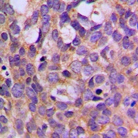 S6K1 (Phospho-T444) Rabbit Polyclonal Antibody