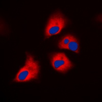 S6K1 (Phospho-T444) Rabbit Polyclonal Antibody