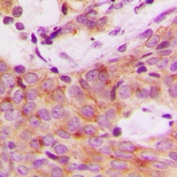 S6K1 (Phospho-S447) Rabbit Polyclonal Antibody