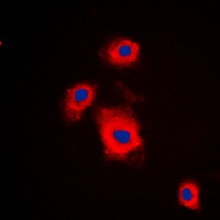 S6K1 (Phospho-S447) Rabbit Polyclonal Antibody