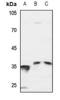 SRSF7 Rabbit Polyclonal Antibody