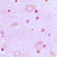 SRSF7 Rabbit Polyclonal Antibody