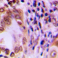 STAT1 Rabbit Polyclonal Antibody