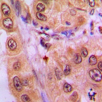 STAT3 (Phospho-Y705) Rabbit Polyclonal Antibody