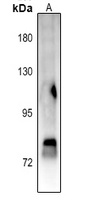 STAT4 (Phospho-Y693) Rabbit Polyclonal Antibody