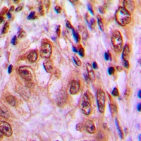 STAT4 (Phospho-Y693) Rabbit Polyclonal Antibody