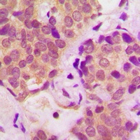 STAT6 (Phospho-Y641) Rabbit Polyclonal Antibody