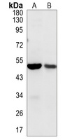 Aurora A Rabbit Polyclonal Antibody