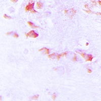 Synapsin 1 (Phospho-S9) Rabbit Polyclonal Antibody