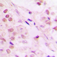 TCEB3 Rabbit Polyclonal Antibody