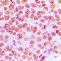AP2 gamma Rabbit Polyclonal Antibody