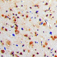Tyrosine Hydroxylase (Phospho-S71) Rabbit Polyclonal Antibody