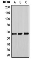 Tyrosine Hydroxylase Rabbit Polyclonal Antibody