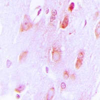 Tyrosine Hydroxylase Rabbit Polyclonal Antibody