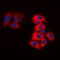 Tyrosine Hydroxylase Rabbit Polyclonal Antibody