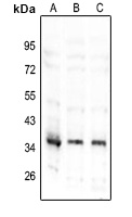 TNFAIP1 Rabbit Polyclonal Antibody