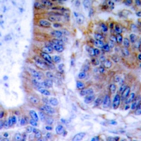 TNFAIP1 Rabbit Polyclonal Antibody