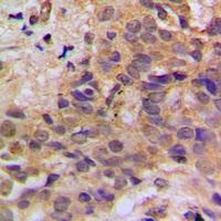 p53 (Phospho-S37) Rabbit Polyclonal Antibody