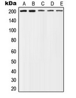 TSC2 (Phospho-T1462) Rabbit Polyclonal Antibody