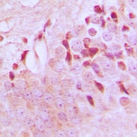 TSC2 (Phospho-T1462) Rabbit Polyclonal Antibody