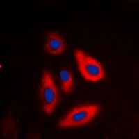 TSC2 (Phospho-T1462) Rabbit Polyclonal Antibody