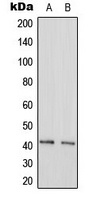 GAS41 Rabbit Polyclonal Antibody