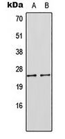 SOCS1 Rabbit Polyclonal Antibody
