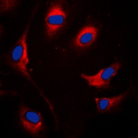 SOCS1 Rabbit Polyclonal Antibody