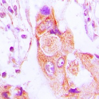AIM2 Rabbit Polyclonal Antibody