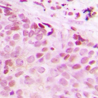 Separase (Phospho-S1126/801) Rabbit Polyclonal Antibody