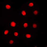 Separase (Phospho-S1126/801) Rabbit Polyclonal Antibody