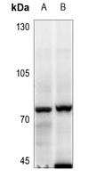 MELK Rabbit Polyclonal Antibody