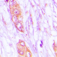 MELK Rabbit Polyclonal Antibody