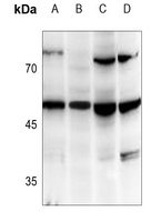 TANK Rabbit Polyclonal Antibody