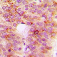 TANK Rabbit Polyclonal Antibody