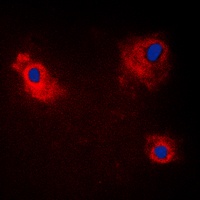 TANK Rabbit Polyclonal Antibody