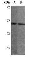 ANGPTL7 Rabbit Polyclonal Antibody