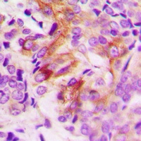 ANGPTL7 Rabbit Polyclonal Antibody