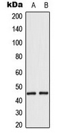 EMP Rabbit Polyclonal Antibody